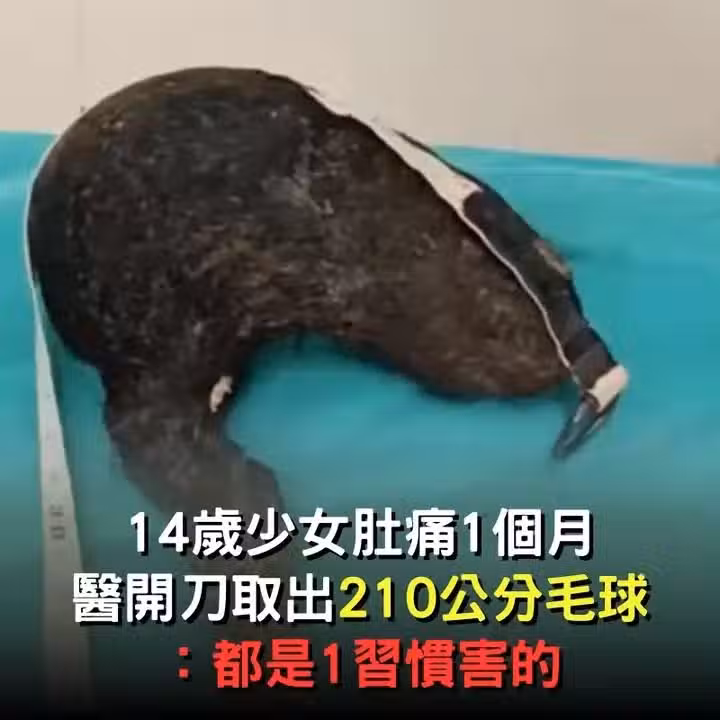 /www/bananadaily.net/web/images/image/2272/22728608.avif
